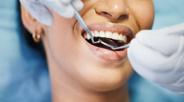 Best Lost Filling or Crown Replacement in Seffner, FL